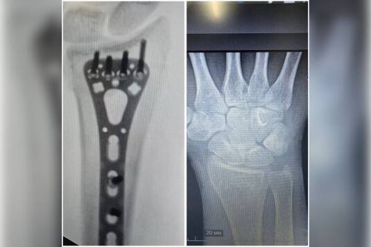  ��������� ����� ���������� �������� 120 �������� �������������� ������ 