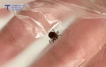 В тюменские медучреждения по поводу присасывания клещей обратились 34 жителя