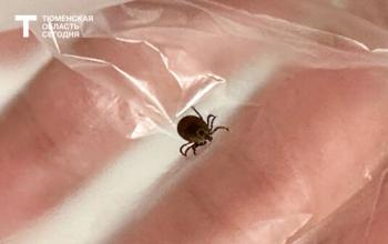 Клещи покусали более 5 600 человек в Тюменской области