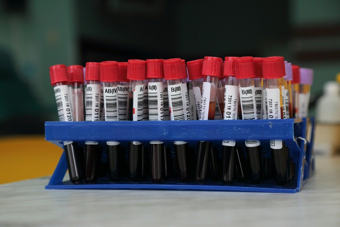 Более 60 тысяч тестов на коронавирус провели в Тюменской области за неделю