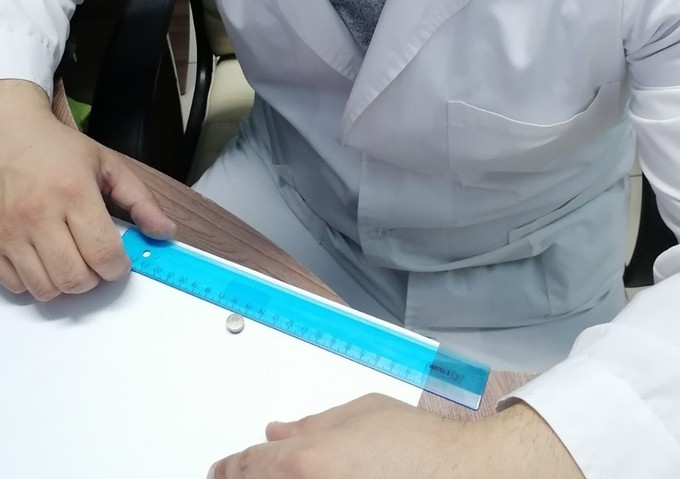 Ишимские врачи успели спасти проглотившего батарейку ребенка 
