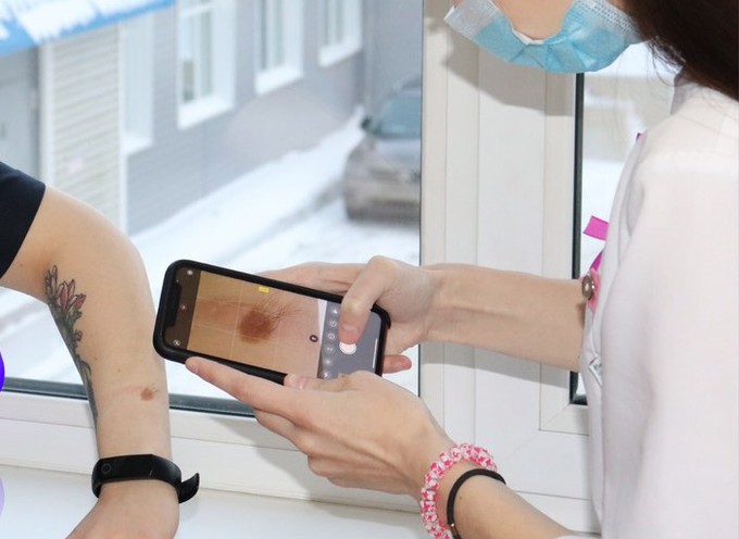 Тюменские медсестры помогают онкологам по фото выявить рак кожи