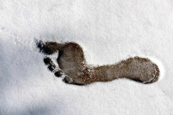 В Тюмени любитель бани обморозил ноги поле пробежки босиком по снегу