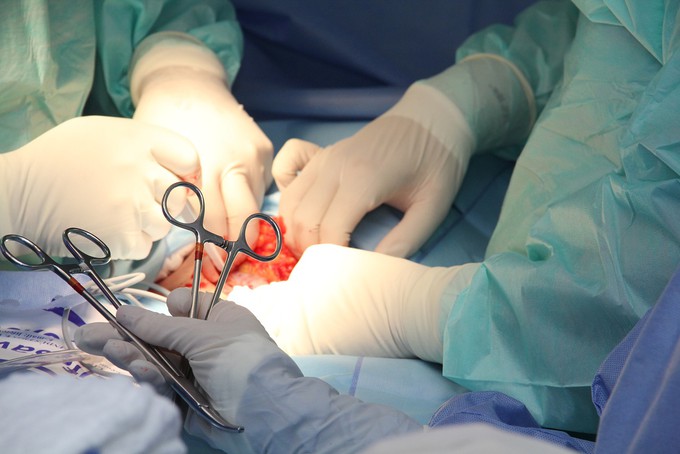 Опыт тюменских хирургов находит признание у коллег