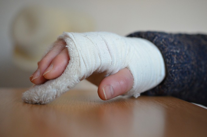 Батутный центр выплатил 30 тысяч рублей за перелом руки у ребенка в Тюмени