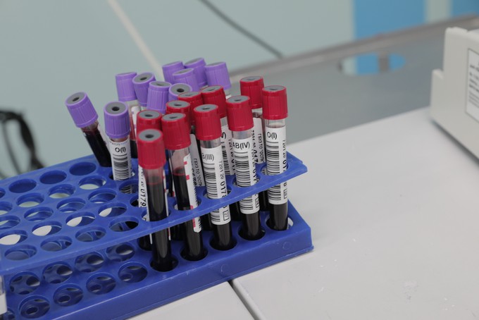 В Тюмени испытания вакцины от коронавируса начнутся 30 ноября